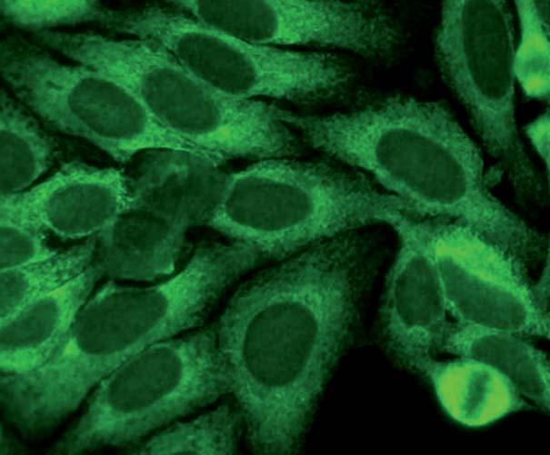 Hepatocyten der zeigen in der Regel eine feingranuläre, über das ganze Organ verteilte Fluoreszenz.
