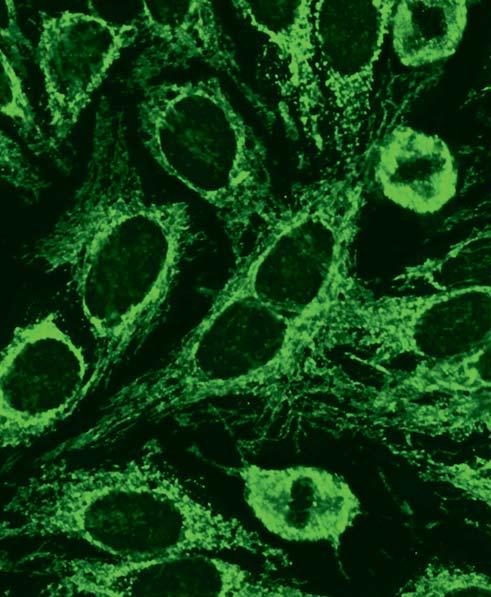 Autoantikörper gegen Mitochondrien (AC-21) enthalten die Antigene M2, M3, M5 und M9, hier erzeugen die Antikörper eine grobgranuläre Fluoreszenz des Cytoplasmas, die den Kern nicht mit erfasst