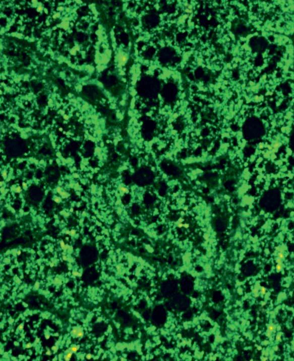 Die Zellkerne sind dunkel. Insgesamt reagiert das Gewebe schwächer als die. Klinische Assoziation: Autoantikörper gegen Mitochondrien können bei verschiedenen Erkrankungen nachgewiesen werden.