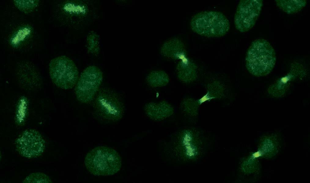 Autoantikörper gegen Trennzone (Midbody) (AC-27) Im indirekten Immunfluoreszenztest zeigen bei Midbody-Antikörpern in der Metaphase der Mitose eine feinkörnige Fluoreszenz der Äquatorialebene.