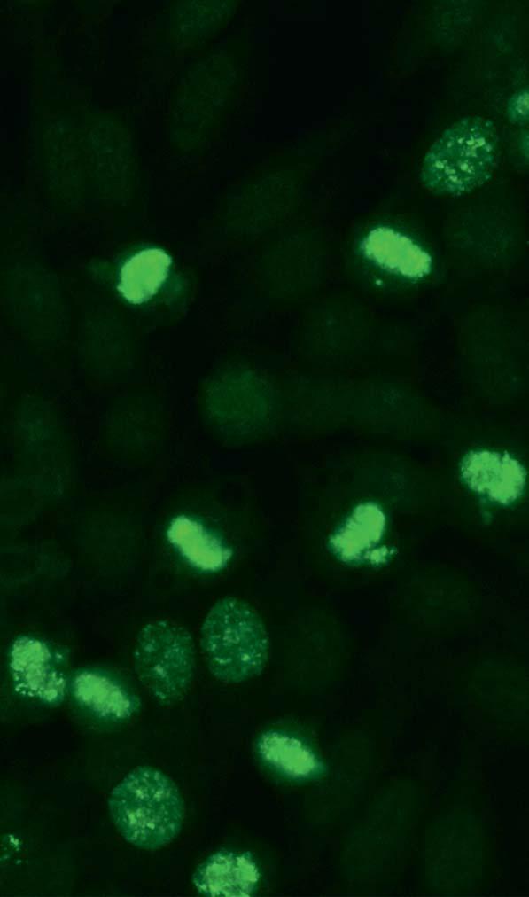 Autoantikörper gegen MCA (AC-28) Bei Hep-2-Zellen zeigen die Chromosomen in der Pro- und Metaphase eine gepunktete Fluoreszenz. Interphasekerne weisen keine Färbung auf.