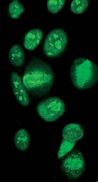 Autoantikörper gegen Topoisomerase I (Scl-70) (AC-29) Rattenniere zeigen eine feingranuläre Kernfluoreszenz der