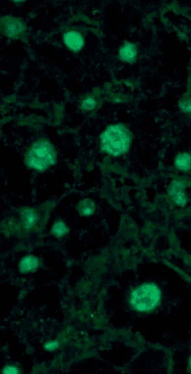 Bei mitotischen Zellen fluoresziert der Randbereich der kondensierten Chromosomen, teilweise ist die gesamte