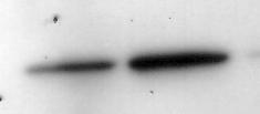 Ergebnisse Neuro2a-Zellen wurden mit 100nM mirna-17-3p oder der Kontroll-RNA transfiziert. Jedes Experiment wurde für jeden Zeitpunkt mit einem Kulturreplikat durchgeführt.