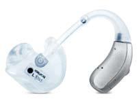 Während beim AS Hörluchs ICP XS, DUO und P in 6 Frequenzbereichen die Verstärkung je nach Hörminderung angepasst werden kann, geschieht dies beim AS Hörluchs ICP K in 6 Frequenzbereichen.