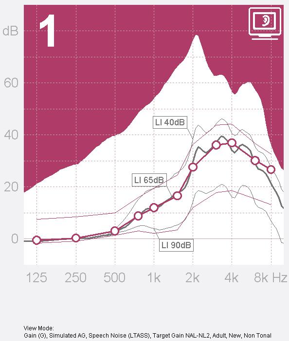 NAL-NL2 NAL-NL2 Mehr als 20 db