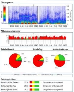 Optimale Analyse des Stress-Levels 24-Stunden HRV- Messung Balance Sympathikus vs.