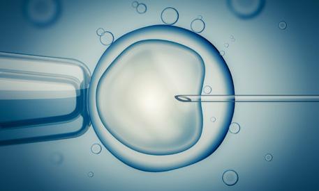 In-vitro-Fertilisation IVF IVF beschreibt die Befruchtung von Eizellen durch Spermien außerhalb des Körpers.