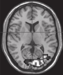 Mittels funktionellem Magnetresonanz-Imaging (fmri) wurden die Wirkungen der beiden Stoffe auf den Parahippocampus, einen Gehirnbereich, der mit Gefühlen in Verbindung gebracht wird, sowie auf den