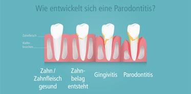 Zum Zahnarzt nicht nur der Zähne wegen! denn der Zahnarzt von heute kann viel mehr als Zähne pflegen!