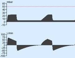 Druckkontrollierte Beatmung PCV: Pressure Controlled Ventilation steiler