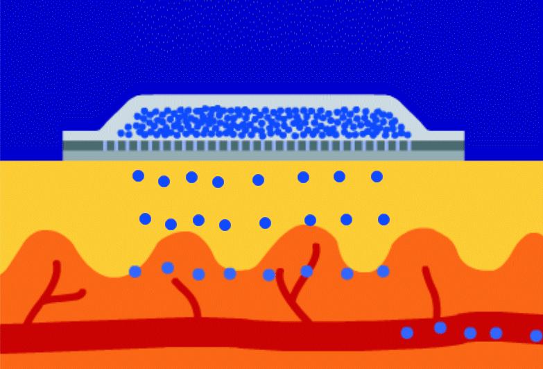 Reservoirpflaster Matrixpflaster Schutzschicht Reservoir permeable Membran