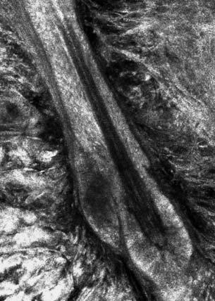 5.2 Aufnahmen der gesunden Haut in der KLM ten der Wurzelscheiden lassen sich nicht genau unterscheiden. Die bindegewebige Wurzelscheide, welche die äußere Wurzelscheide umgibt, ist dunkelgrau.