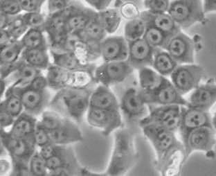 Die Inkubation der Hct-116 Zellen mit 1 µm Doxorubicin für 3 h führte zu einer deutlichen Vergrößerung der Zellen und der Zellkerne im