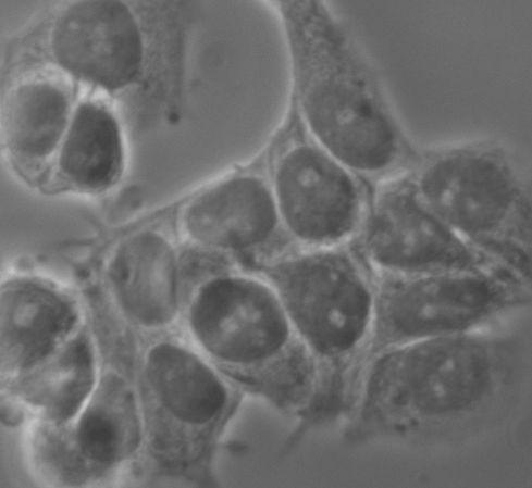 Durch die Überexpression der Katalase sollten die MCF-7kat und MCF-7kat Zellen weniger sensitiv gegen eine Schädigung Viabilität [%] A 1 8 6 4 2 * * MCF-7wt MCF-7kat B * 6 * * * * 4 * * MCF-7wt * 2