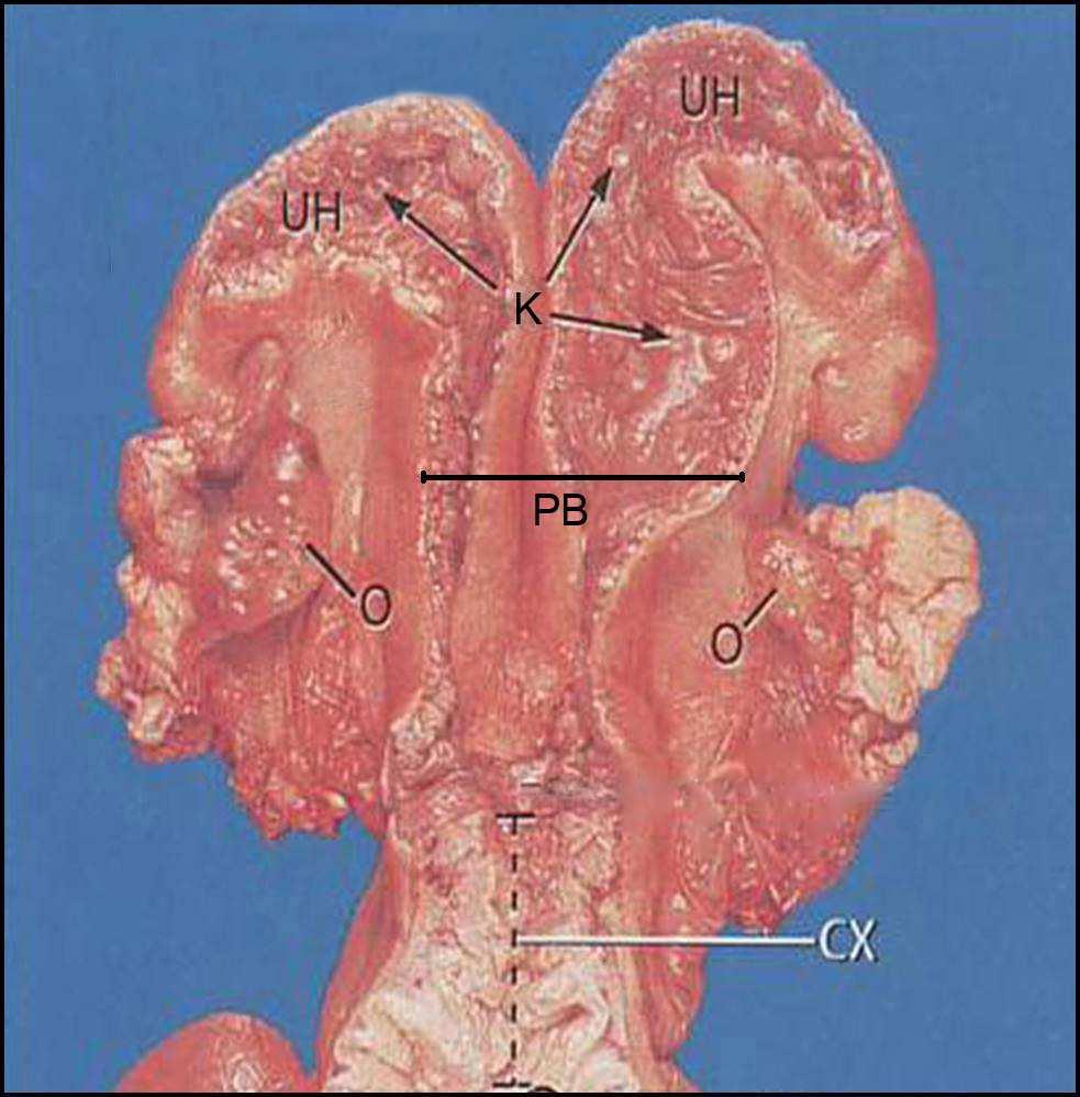 3 Material und Methoden 3.3 Probenentnahme und Probenaufbereitung 3.3.1 Endometriumbioptate Die Endometriumbioptate der klinisch genitalgesunden Kühe (Gruppen A 1 und A 2 ) wurden unter rektaler Kontrolle mit einer scharfen Biopsiezange nach KEVORKIAN (Fa.