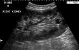Abdominale Sonographie beim Rind 47 Ultraschall - Niere Ultraschall - Niere Lokalisation: rechte Niere: perkutan; 12.