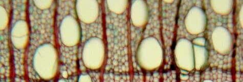 Nach innen differenziert der kambiale Ring Xylemzellen oder Holzstrahlparenchym, nach aussen Phloenzellen oder Baststrahlparenchym.