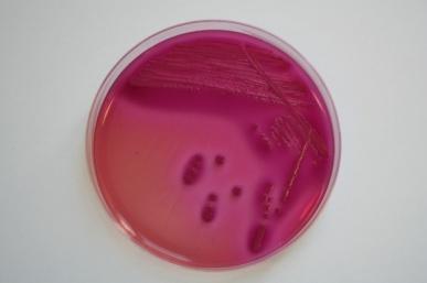 2.2 Methoden Quantitative Bestimmung von coliformen Keimen bzw. Escherichia coli in Anlehnung an die Methoden L 01.