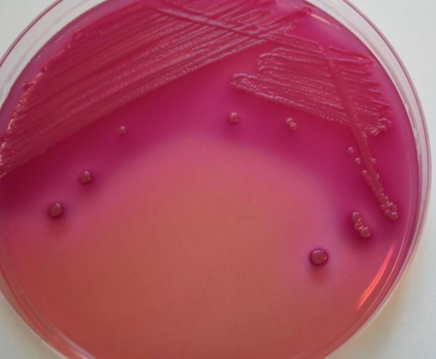 3. Ergebnisse Methodische Aspekte zum Nachweis von Enterobacteriaceae in Frischkäse ECC-Agar