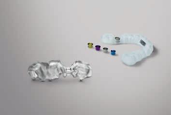 14 I 15 1 2 Der einfache Weg zum Implantat Ein sicher platziertes und prothetisch optimal ausgerichtetes Implantat dank perfekt aufeinander abgestimmter Soft- und