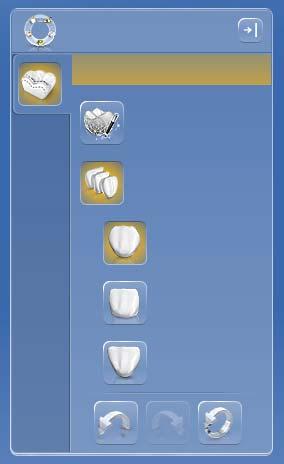 Sirona Dental Systems GmbH 4 Designmodus 4.5 Bio-Kiefer Schritt Morphologie Im expandierten Schrittmenü steht Ihnen der optionale Schritt "Morphologie" zur Verfügung.