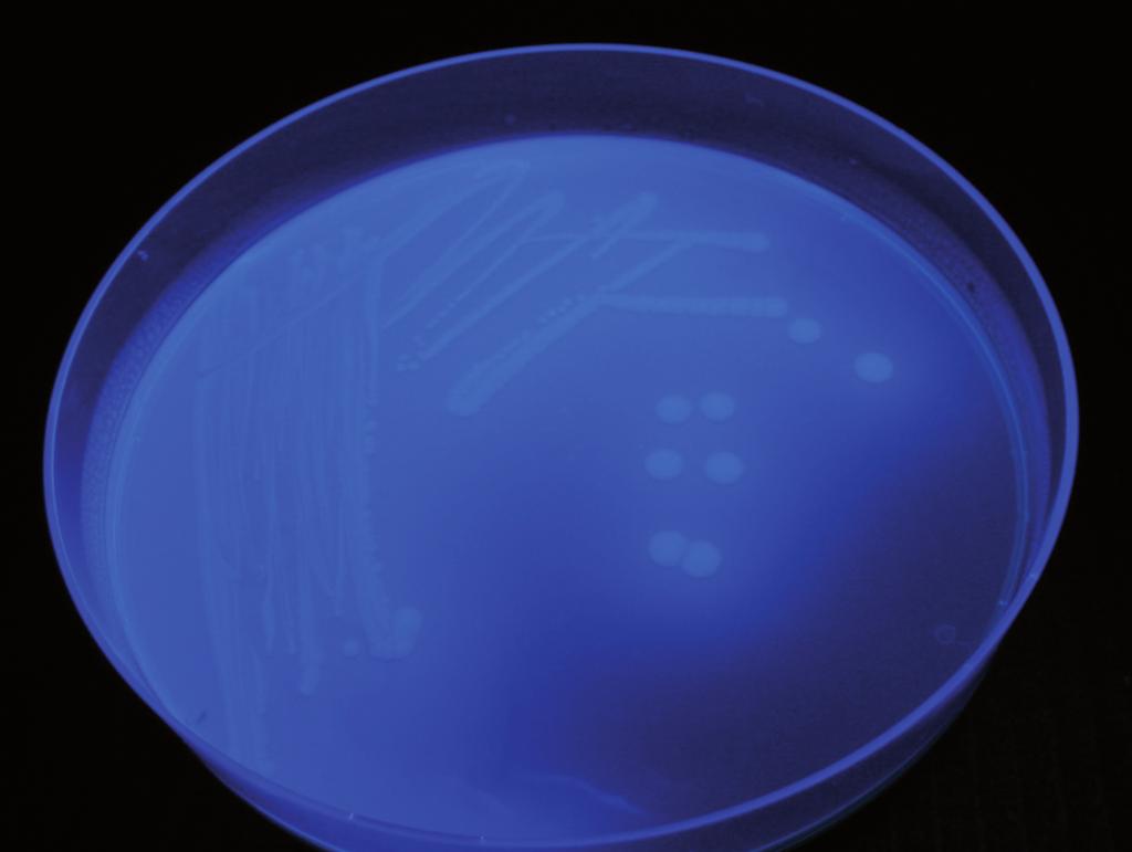 coli: Weiße Kolonien mit Fluoreszenz unter UV-Licht Mikrothek