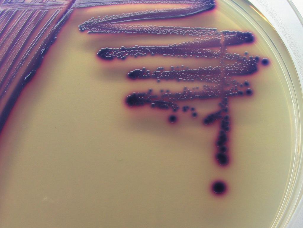 (siehe Pfeile) E. coli wächst violett (siehe Pfeil) Andere Bakterien wachsen farblos BRILLIANCE E.