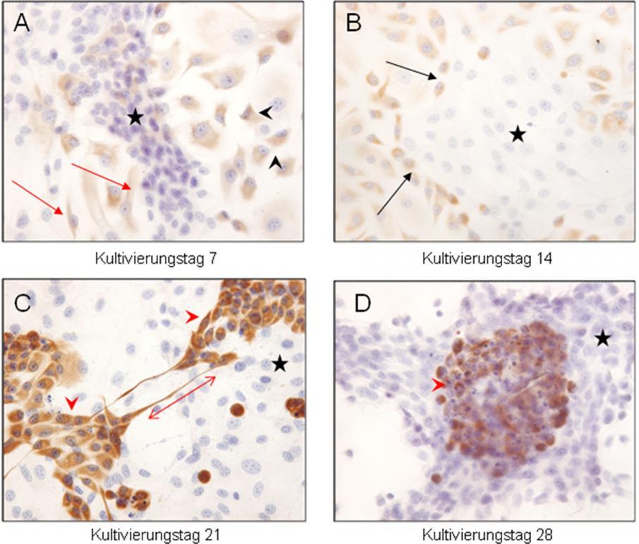 Ergebnisse Abbildung 43: Immunzytochemischer Nachweis von CK19 in Endothelzellen im direkten Kokultur-System 3 (Suspension) in vitro A-D: Immunopositive Reaktion von Endothelzellen in allen Kulturen