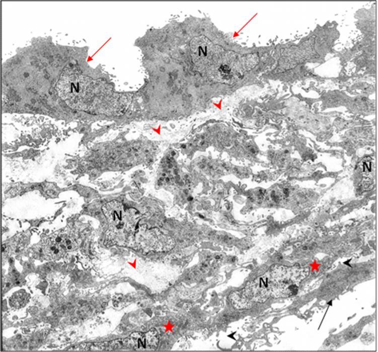 Ergebnisse Abbildung 64: Ultrastruktur des direkten Millicell -PCF-Systems 2 (E+K), 21 bis 28 Tage in Kultur Mehrlagige Zellansammlung aus Endothelzellen auf einem mehrlagigen Zellrasen aus