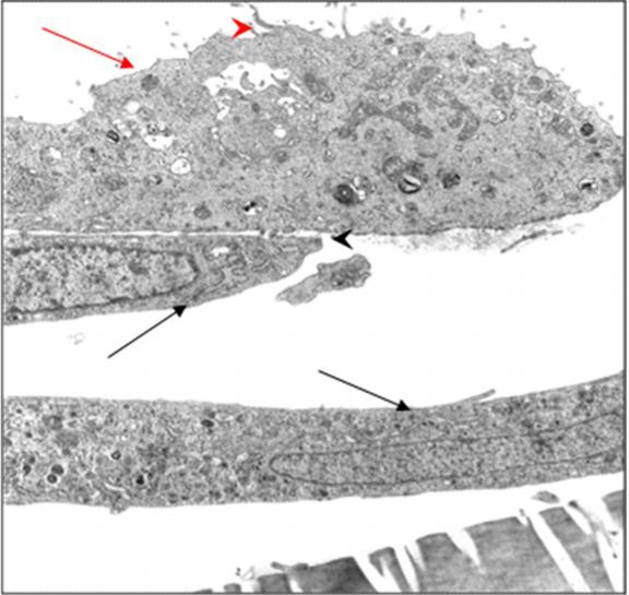 Ergebnisse lokalisiert. Nur wenige Mitochondrien vom Crista-Typ konzentrierten sich in Zellkernnähe. Gleichzeitig konnten zahlreiche Golgi-Felder und Lysosomen in Zellkernnähe beobachtet werden.