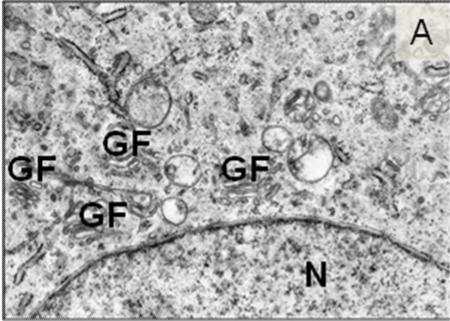 Ergebnisse Abbildung 67: Ultrastruktur des direkten Millicell -PCF-Systems 3 (Suspension), 7 Tage in Kultur A: Zahlreiche Golgi-Felder (GF) in Zellkernnähe in Keratinozyten. Nukleus (N).