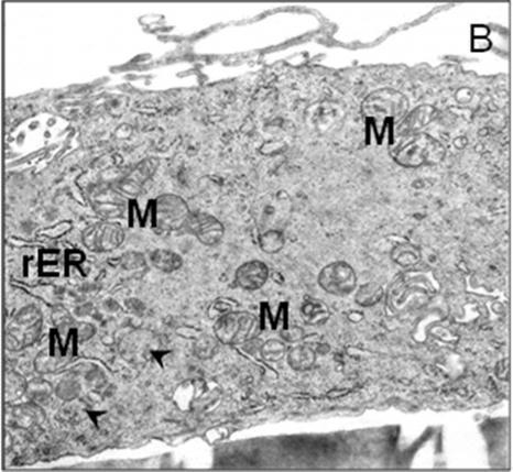 000 Nach 14 Tagen in Kultur wies jeder Keratinozyt eine langgestreckte Gestalt mit langgestrecktem Zellkern auf. Die Zelloberfläche erschien glatt mit geringgradigen Unregelmäßigkeiten.