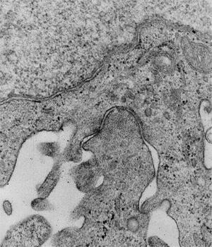 In den Interzellularraum zwischen Endothelzellen hineinragende Mikrovilliähnliche Zellfortsätze (rote Pfeilspitze).