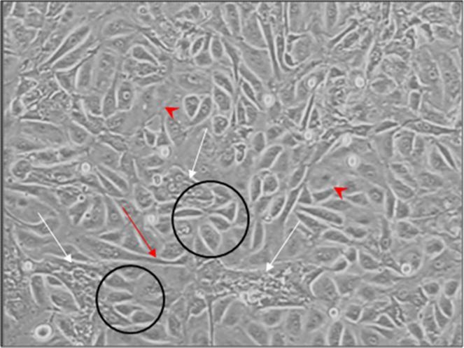 Ergebnisse Endothelzellkolonien zu dichten sternförmigen Zellclustern. Einzelne Zellen in diesem Zellverband waren phasenkontrastmikroskopisch nicht zu differenzieren.