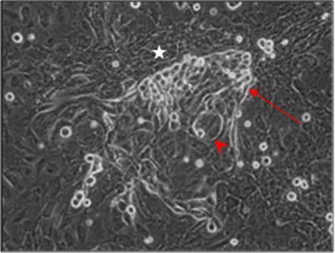 Phasenkontrastmikroskopie x 200 Die von den zahlreichen Clustern ausgehenden Zellausläufer verbreiterten sich vom 6. bis 10. Kultivierungstag zu dichten Zellstraßen (Abbildung 41/A).