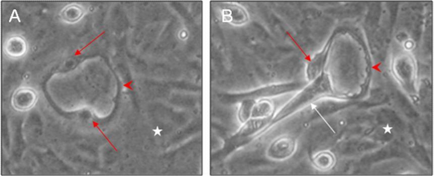 Ergebnisse In diesem Beobachtungszeitraum konnten des Weiteren vereinzelt auf den Keratinozyten ringförmige Strukturen aus zwei oder mehreren länglichen zirkulär angeordneten Endothelzellen