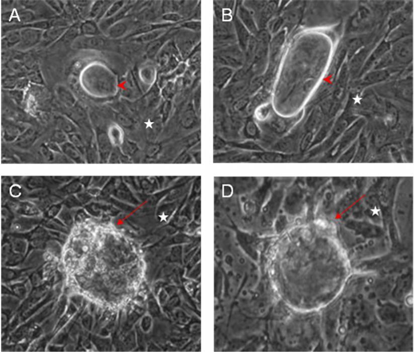 Ergebnisse Abbildung 31: Direktes Kokultur-System 2 (E+K) nach 28 Tagen in Kultur A-D: Ringförmige Strukturen aus Endothelzellen auf Keratinozytenzellrasen (Sterne).