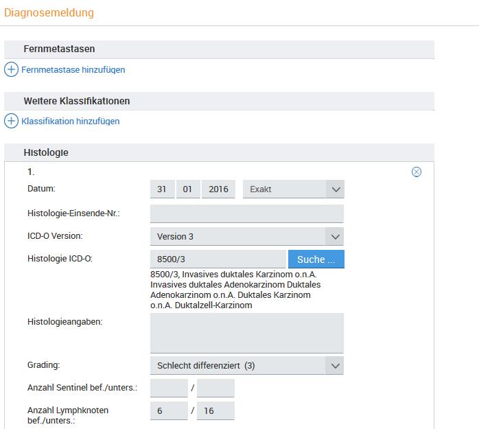 Hauptdiagnose: schlecht differenziertes, invasives ductales Mammakarzinom links oben außen NST-Mammakarzinom: pt3, pn2 (6/16) G3, L1(intratumoral), V0, Rx, cm0 Max Tumordurchmesser: 5,2 cm (NET) Min