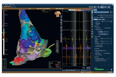 3D-Mapping im EPU-Labor (EnSite Precision TM Cardiac Mapping System) Dieses Seminar richtet sich an Elektrophysiologen und EP-Assistenzpersonal, die das EnSite System selbständig bedienen wollen und