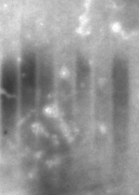 DNA mit den Enzymen HinfI und RsaI verdaut, auf einem 0,5% Agarosegel aufgetrennt, dann auf eine Hybond XL-Membran transferiert und mit einer radioaktiv-markierten Sonde gegen die Telomere