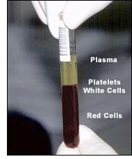 Bestandteile des Blutes - Plasma und
