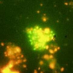 1%) vorgefärbtes 0.2 µm Nuclepore- Filter abfiltriert.