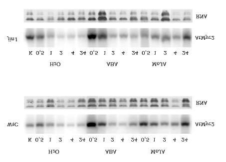 3. Ergebnisse Abbildung 3.3.15.: Northern-Analyse: Expression von At- MYC2 in WtC und jin1 nach Applikation von ABA (50µM) und MeJA (50µM).