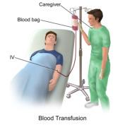 Bluttransfusion Seit wann transfundiert man? Was wird heute transfundiert? Was ist eine Transfusion - Transfusionskette? Wieviel transfundieren wir in der Schweiz?