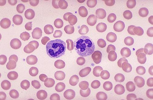 Was machen die Blutzellen? Blutzellen unter dem Lichtmikroskop Infektabwehr Blutgerinnung Sauerstofftransport Folie 7, Dr.R.Savoca / Dr.G.Wagner Was macht das Blutplasma?
