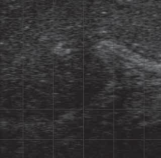 RINDUNDWIR September 2016 Schwarz-Weiß-Fernsehen im Kuhstall Die Ultraschalluntersuchung ist ein wertvolles Instrument, um die Fruchtbarkeit der Herde genauer unter die Lupe zu nehmen In vielen