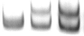 a b c D6S1003 Vater Abort Mutter Abbildung 47 Fall V-2309/01: Polyacrylamidgelelektrophorese mit hochpolymorphen Markern: D6S1003 zeigt Dosiseffekt für 6q23.