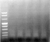 Unabhängig von der eingesetzten DNA-Menge war die Ausbeute insgesamt geringer als bei DNA aus nativem Blut. Die Größe der PCR-Produkte lag im Bereich von ca. 1000bp.