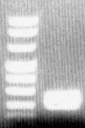 spezifischen DNA-Vermehrung zeigte, dass aufgrund des im Kit enthaltenen Enhancers und verbesserter DNA-Polymerase- Aktivität Amplifikationen auch bei unzureichender DNA-Qualität zu verzeichnen waren.